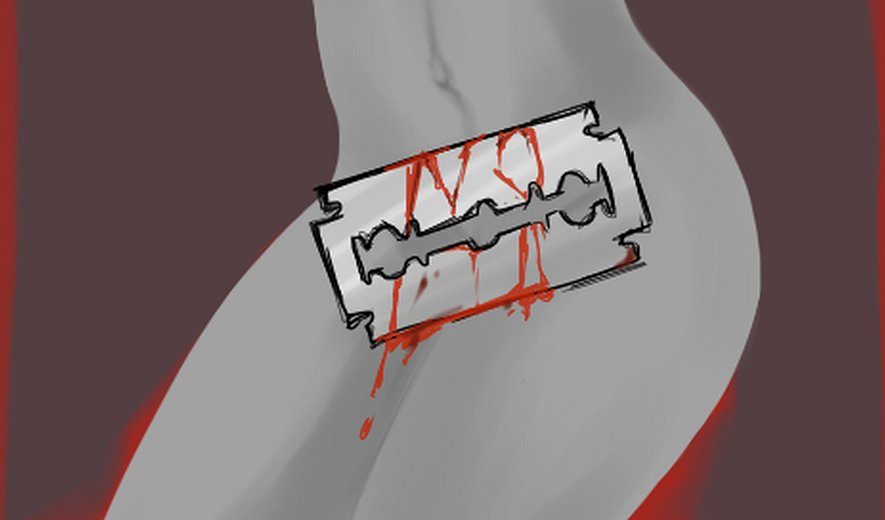  ناقص سازی جنسی زنان، دغدغه‌ای که نباید فراموش شود