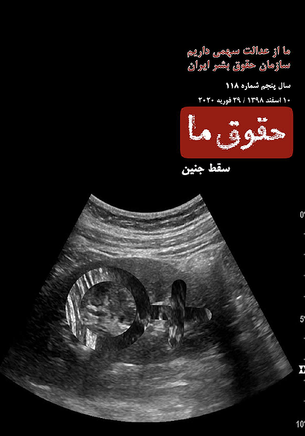 شماره ۱۱۸ مجله حقوق ما؛ سقط جنین