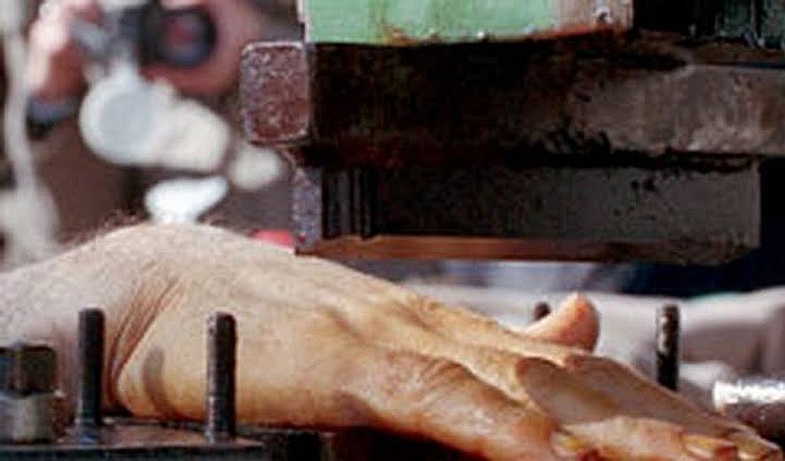 Iranian authorities cut off a man's hand for stealing