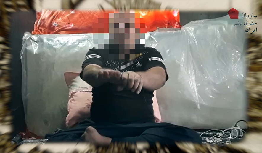 مستند «روایت قطع دست» منتشر شد