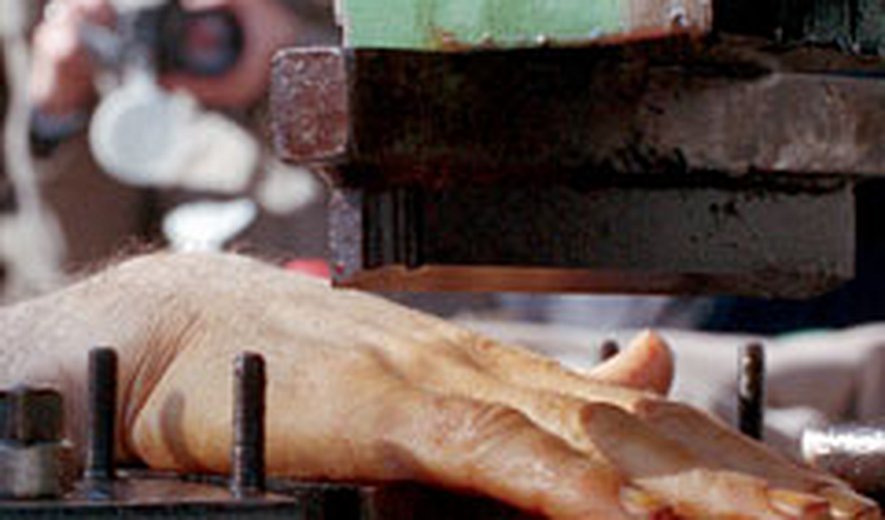 Iranian Authorities Carry Out Amputation Sentences  Of Two Prisoners On Christmas Day