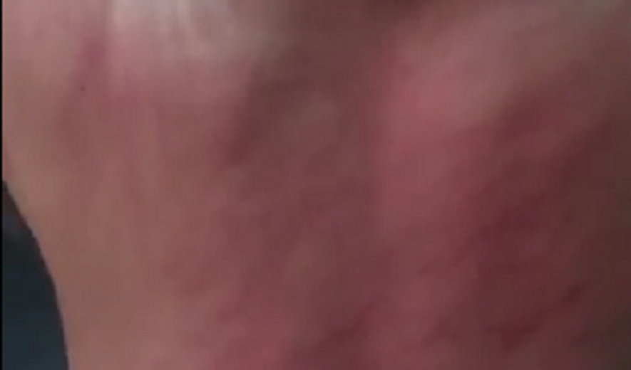 Woman Asylum Seeker Lashed 80 Times After Being Deported to Iran From Norway