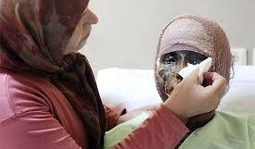 اعدام برای اسید‌پاشی: تولید یک چرخه خشونت دیگر 