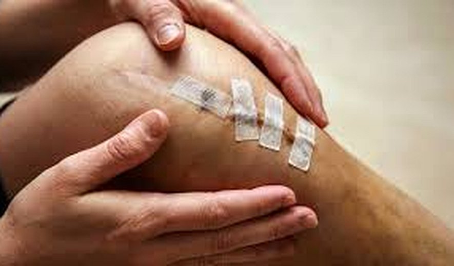 جبران خسارت‌های مادی در قانون ایران با پرداخت ارش