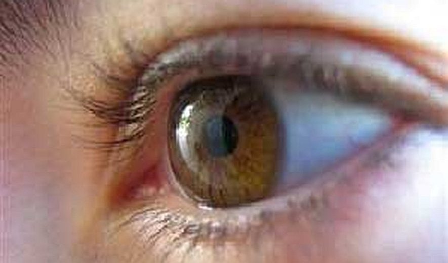 Iran Supreme Court Issues Man Gouging of Eye Punishment