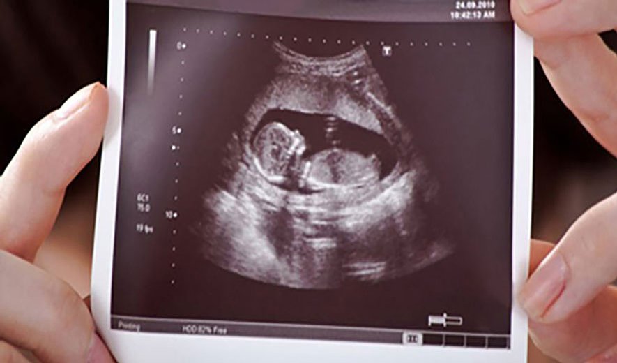 سقط جنین از منظر فقهای شیعه